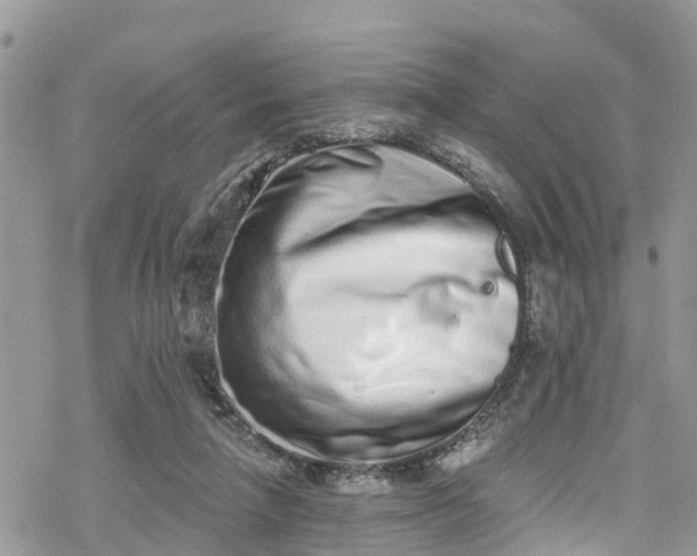 X0000078250258200611171531