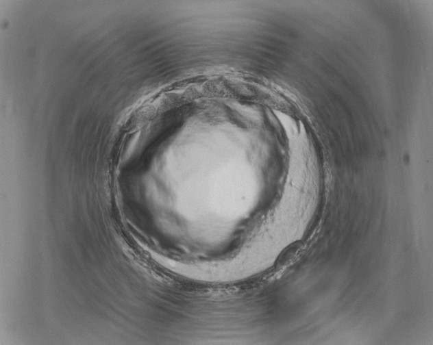 X0000078250345200611251309
