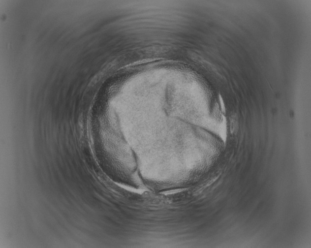 X0000078251011200612011624