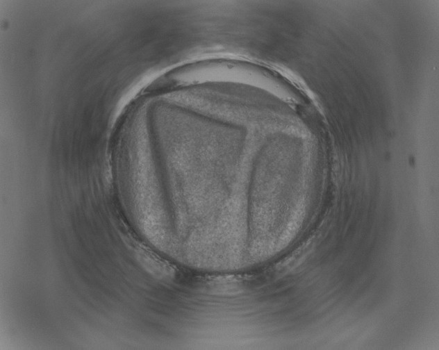 X0000078251167200612011622