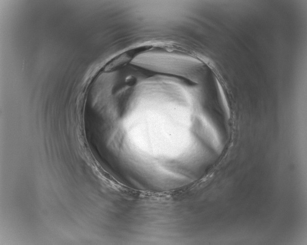X0000078260337200611172010