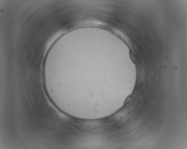 X0000078261103200612011648