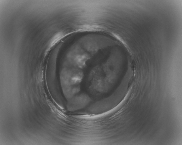 X0000078281459200611101121