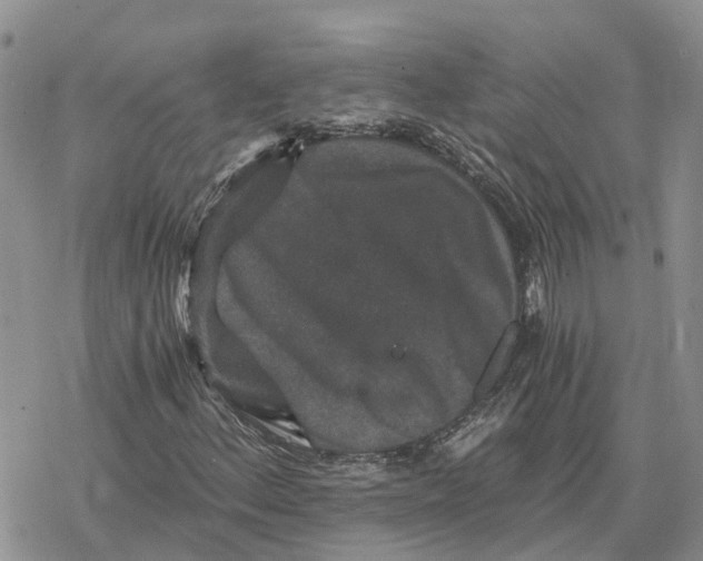 X0000078281156200611251411