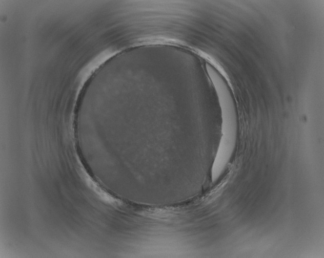 X0000078280995200612011740