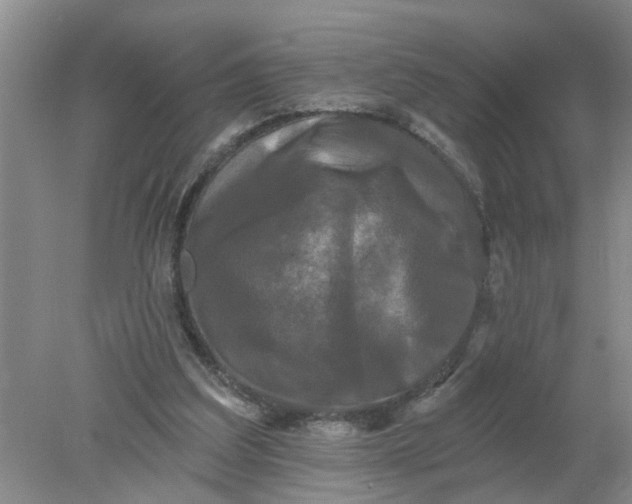 X0000078290203200611172131