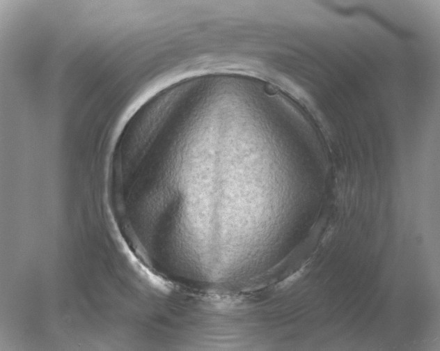 X0000078291520200611172109