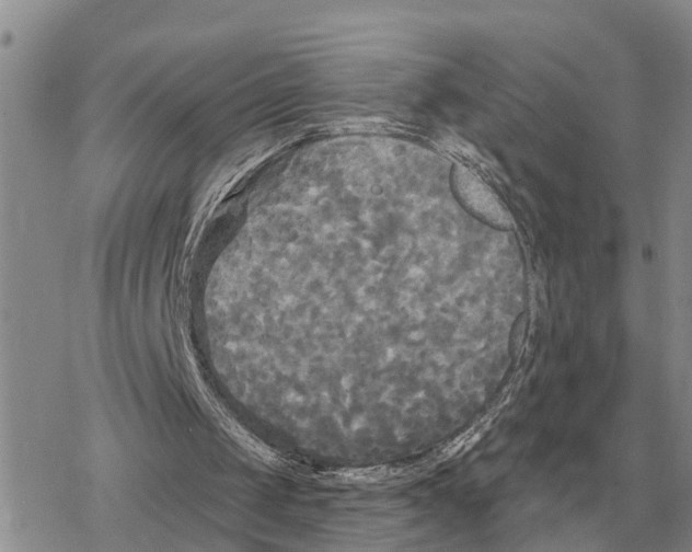 X0000078290049200611251453