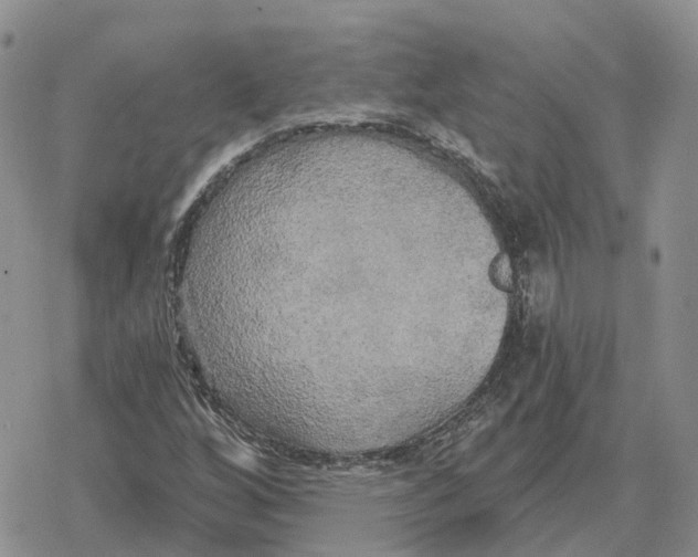 X0000078291256200611251434