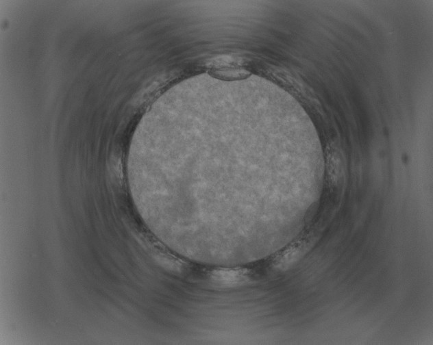 X0000078290375200612011815