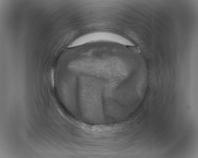 X0000078300022200611172200