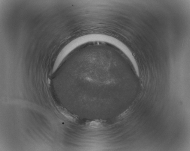 X0000078300180200611172157