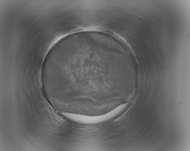 X0000078301174200611172140