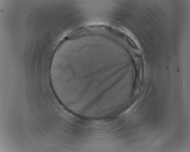 X0000078300385200612011840