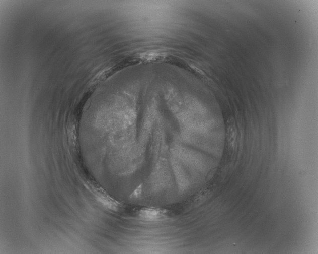 X0000078310375200611172221