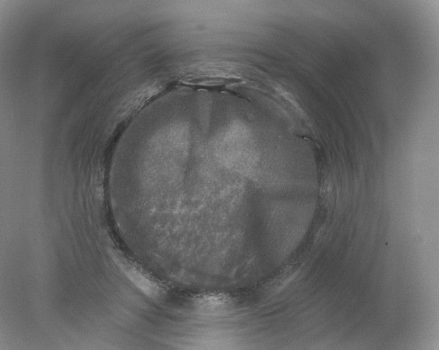 X0000078310402200611172220