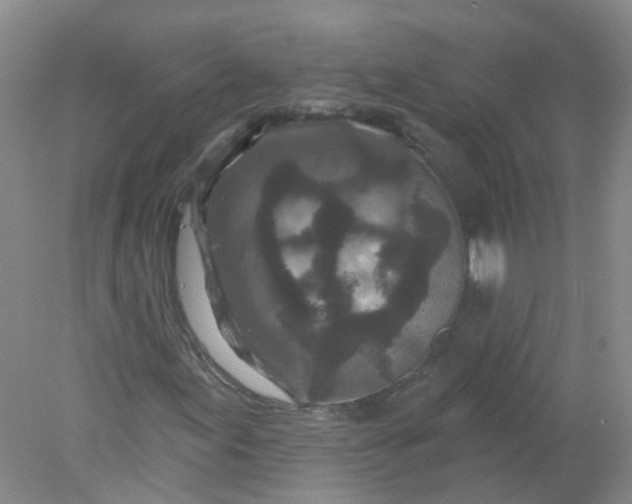 X0000078311155200611172207