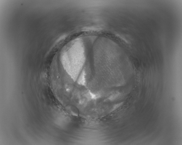 X0000078311254200611172206