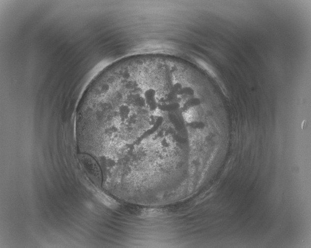 X0000078311275200611172205