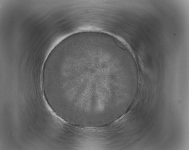 X0000078311295200611172205