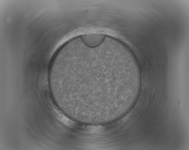 X0000078311498200611172201