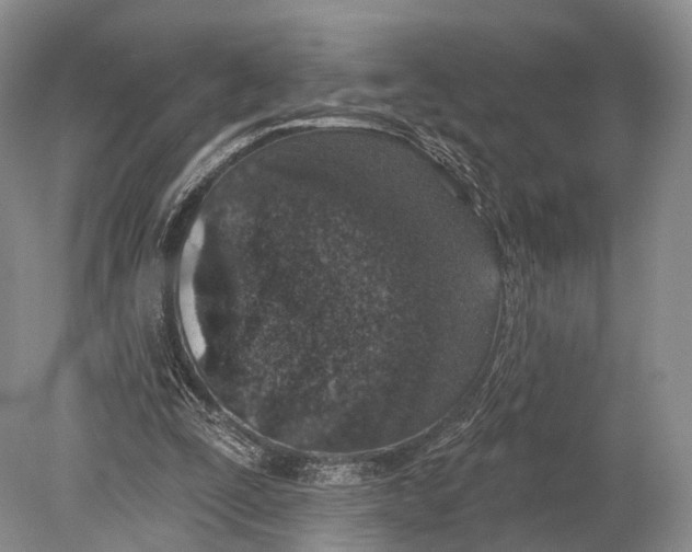 X0000078830295200612041820