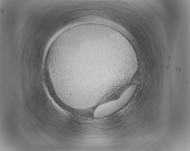 X0000078831536200612111507