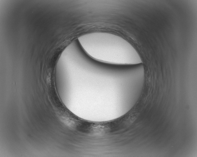 X0000078840315200611131004