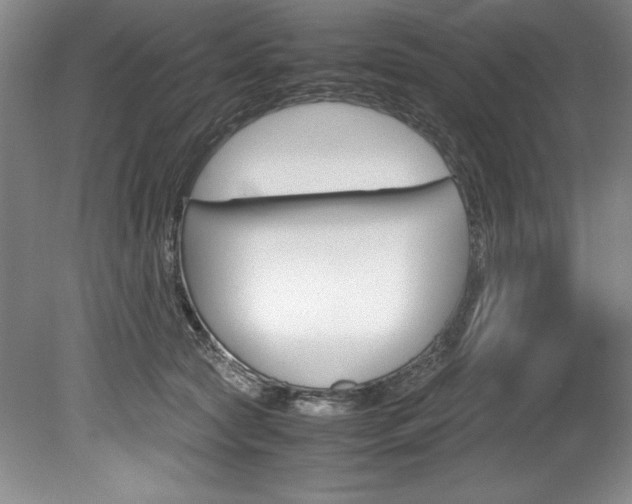 X0000078840561200611131000