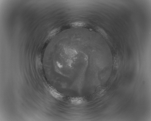 X0000078840377200611131155