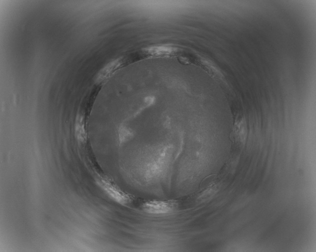 X0000078840381200611131155