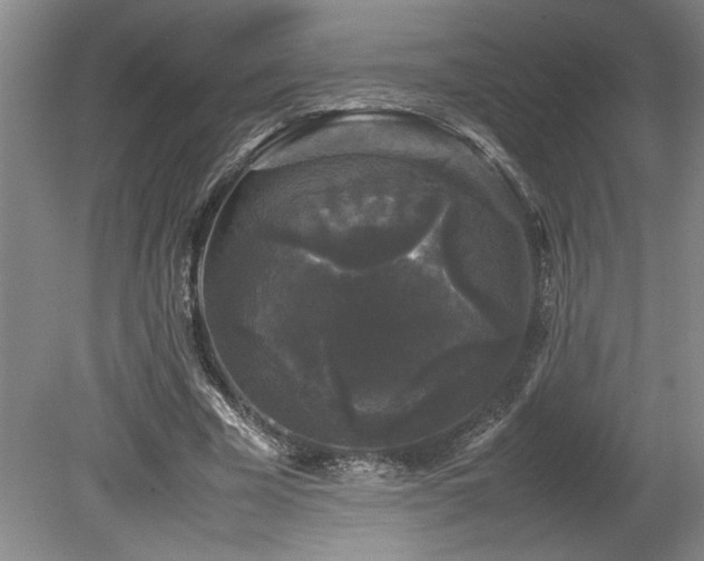 X0000078840585200611131151