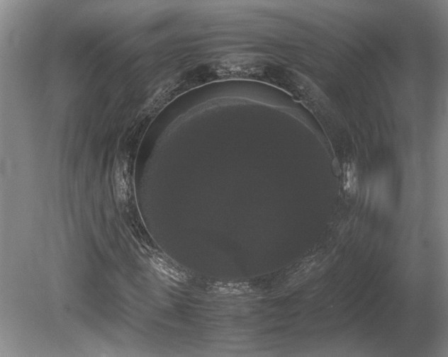 X0000078840915200611131145