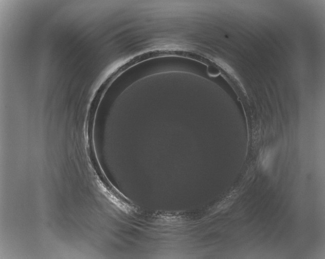 X0000078840935200611131145