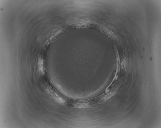 X0000078841156200611201306