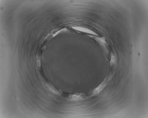 X0000078840180200611271331