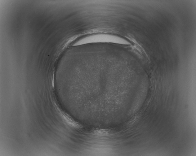 X0000078840062200612041850