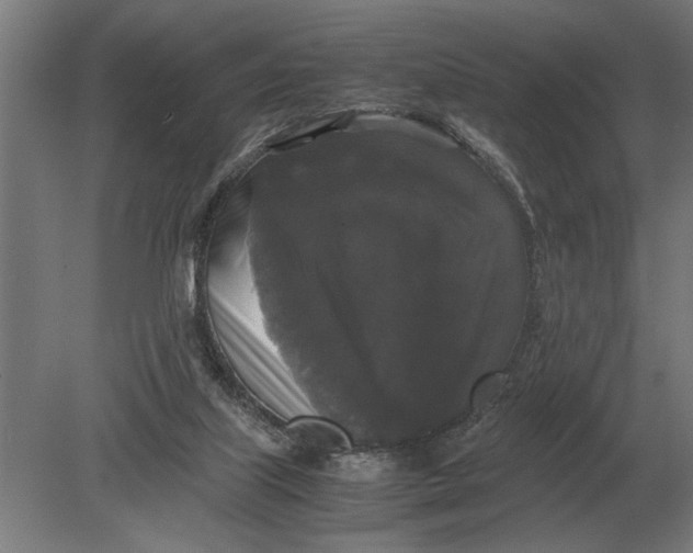 X0000078840067200612041850