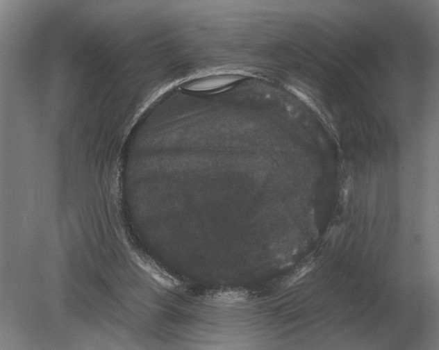 X0000078840156200612041848