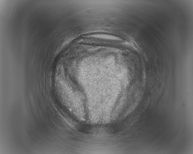 X0000078840299200612041846