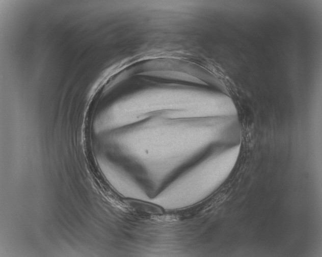 X0000078840340200612041845