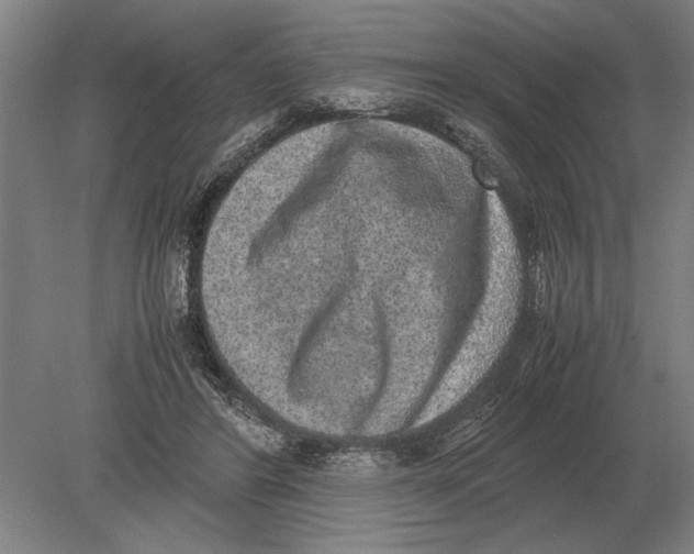 X0000078840404200612041845