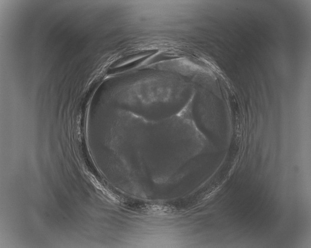 X0000078840585200612041841