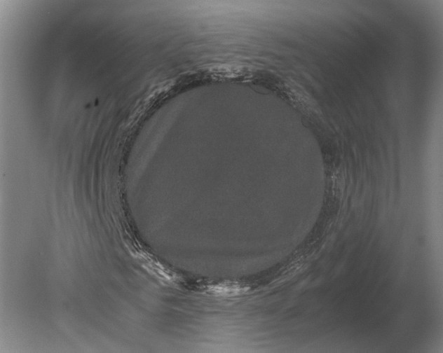 X0000078840961200612041835