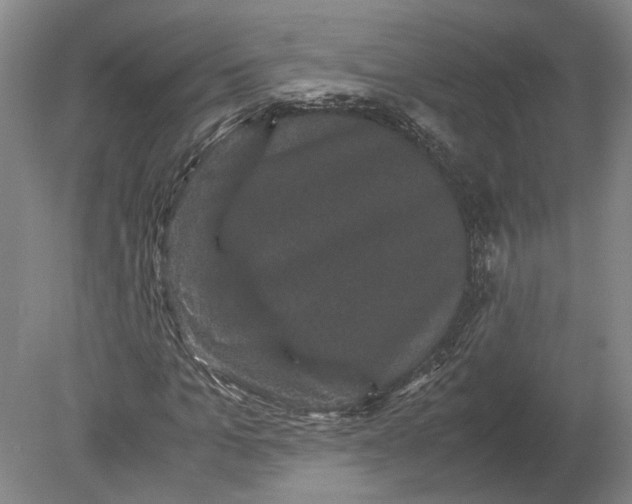 X0000078840965200612041835