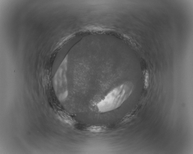 X0000078841157200612041832