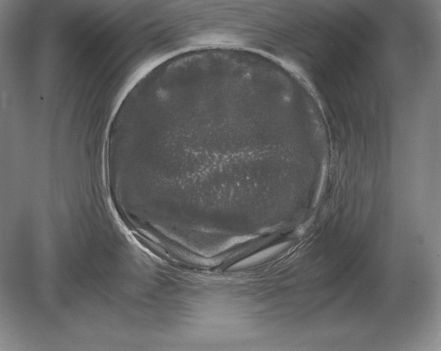 X0000078841295200612041829