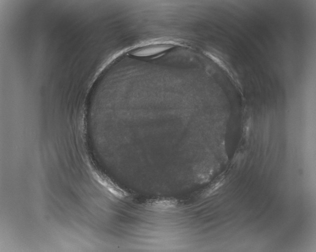 X0000078840156200612111604