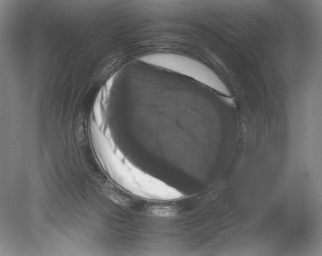 X0000078840169200612111605