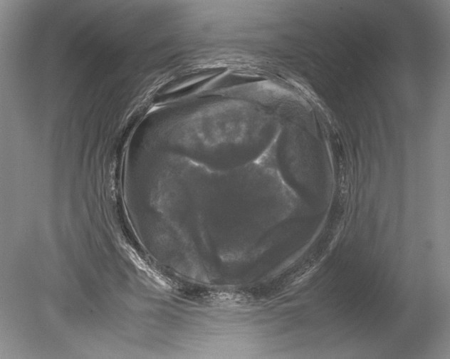 X0000078840585200612111557